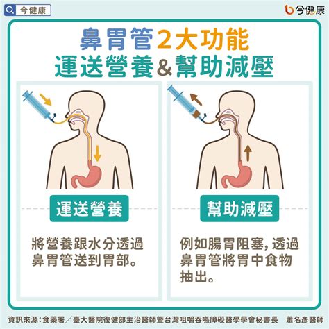 鼻胃管反抽顏色代表意義|【照護技巧】管灌餵食與鼻胃管的照護技巧